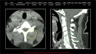 137 Years of Medical Malpractice Part 3 | Free Radiology CME