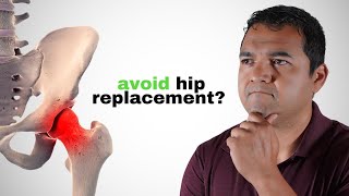 Can You Actually Cure Hip Arthritis and Avoid Replacement Surgery?