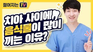 치주질환 의심? 치아에 음식물이 많이 끼는 이유? - 젊어지는치과