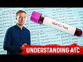 What is A1C Test? Is it an Accurate Blood Test? – Dr.Berg