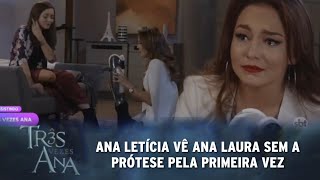 Três Vezes Ana - Ana Letícia vê Ana Laura sem a prótese pela primeira vez e fica impressionada