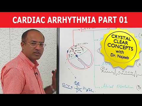 Cardiac Arrhythmia - Part 1/3 Cardiac Arrhythmia - Part 1/3