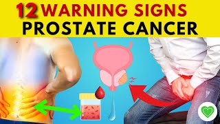 12 Warning Signs Of Prostate Cancer You Should Not Ignore | Prostate Cancer Symptoms