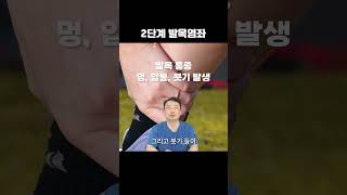 발목이 이상하다면 꼭 보세요! #shorts