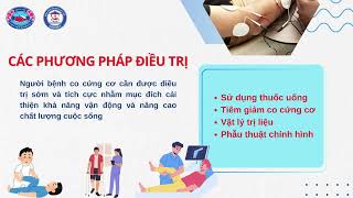 Điều trị co cứng cơ