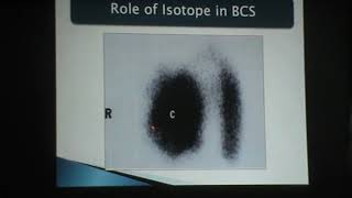 محاضرا.د/ طلال عامر ضمن ندوة الجهاز الهضمى CT in venous anomalies of the liver