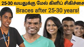 பல் கிளிப் 25-30 வயதுக்கு மேல் போடலாமா? Teeth braces after 25-30 years, adult braces in tamil