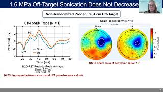 Erica McCune: A Reduction of Somatosensory Evoked Potentials Using FUS Median Nerve Stimulation