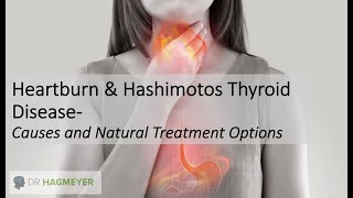 Heartburn and Hashimotos Thyroid Disease-Symptoms, Causes and Natural Treatment Options