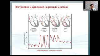 Инвазивный мониторинг центральной гемодинамики Омаров Ю.А.