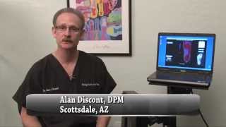 Brace for Adult Flatfoot, PTTD and Drop Foot - Chandler, Sun Lakes, Phoenix, AZ - Podiatrist