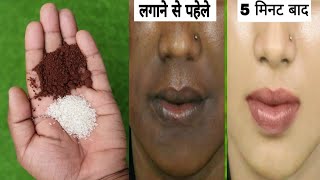 5 मिनट में चेहरा साफ और गोरा करने का घरेलू उपाय - Skin Whitening | Gora hone ka tarika