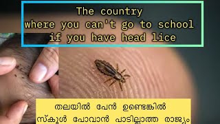 തലയിൽ പേൻ ഉണ്ടെങ്കിൽ സ്കൂൾ പോവാൻ പാടില്ലാത്ത രാജ്യം