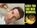 How to remove EAR WAX at home using HYDROGEN PEROXIDE (H202) solution | Doctor O'Donovan explains