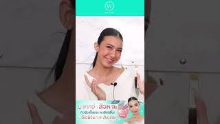 สิวแบบไหนก็เอาอยู่ ฉายแสงรักษาสิว | Perfect Light Acne Program