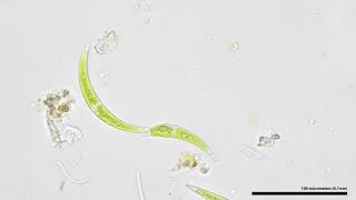 Closterium sp. algae