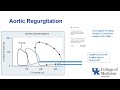 anesthesia for aortic valve surgery