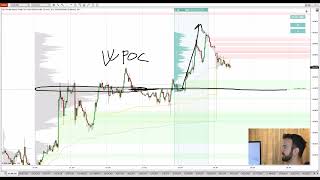 🎯 Top Volume Profile Levels to Trade This Week on ES, EUR/USD and AUD/USD