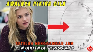 Hanya Dengan Menggambar Jam, Penyakit Langka Wanita Ini Akhirnya Terungkap