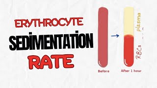 Erythrocyte Sedimentation Rate #esr