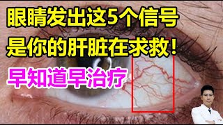 眼睛发出这5个信号，是你的肝脏在求救！早知道早治疗丨李医生谈健康【中医养生】