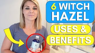 6 Surprising Witch Hazel Benefits Uses