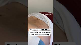 Prolozone and MLS Laser Treatment can take away pain permanently