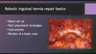 Inguinal Hernia 18 Building an Efficient Inguinal Hernia Program