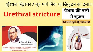 Urethral stricture यूरिथ्रल स्ट्रिक्चर / मूत्र मार्ग निंदा या सिकुड़न का इलाज Dr.Santosh Kumar PGI.