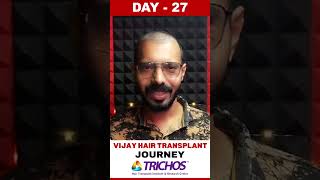 #AskDrJohnWatts | DAY - 27 of VIJAY’S HAIR TRANSPLANT JOURNEY | #besthairtransplant #drjohnwatts