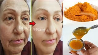 56 years old looks 22 | Anti-aging treatment to remove wrinkles around the eyes and forehead