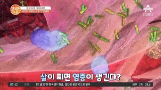 살이 찌면 염증이 생긴다?! '만성염증'이 생기는 이유! | 행복한 아침 620 회