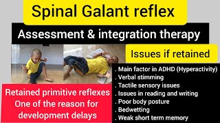 Spinal galant reflex/how to integrate retained spinal galant reflex/OT/primitive reflex integration