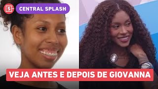 Giovanna do BBB 25 antes e depois: cirurgiões mostram mudanças faciais de irmã da Gracyanne!