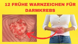 12 Frühe Warnzeichen für Darmkrebs, die Sie nicht ignorieren dürfen!