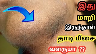 இது மாதிரி இருந்தால் தாடி மீசை வளருமா வளராதா ?? | BeArD will Grow Are Not | Mr. BeArD TiPs