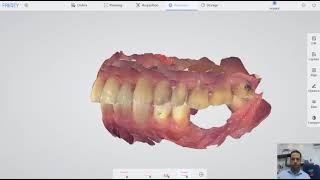 Escaneando Implantes - Tutorial