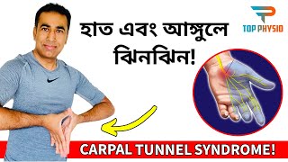 হাত ঝিনঝিন ও অবশ ভাবের কারণ ও চিকিৎসা ৷ Hand Numbness | 10 Best Exercises \u0026 Tips for CTS #Top Physio