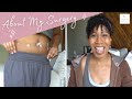 My Laparoscopic Myomectomy: Fibroid Surgery Advice