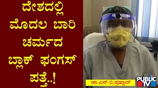 Karnataka Reports First Case Of Black Fungus On Skin In Chitradurga