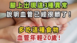 血管堵塞腳先知！腳上出現這3種異常，暗示血管已經很髒了！多吃這種食物，血管年輕20歲！早看早受益！【健康管家】