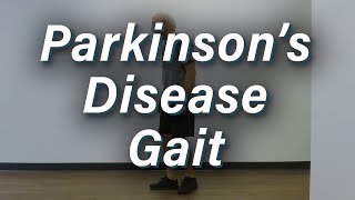 Parkinson's Disease Gait - Moderate Severity