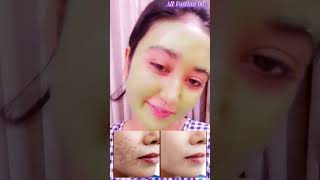 ত্বকের ব্রণ দূর করুন নিমিষেই 🥰 #acnetreatment #beautytips #homemadebeauty