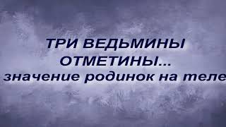 ТРИ ВЕДЬМИНЫ ОТМЕТИНЫ... ЗНАЧЕНИЕ РОДИНОК НА ТЕЛЕ.