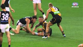 Charged - AFL MRP Round 2 2014