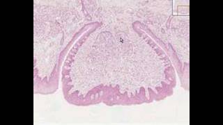 Shotgun Histology Tongue Circumvallate Papilla