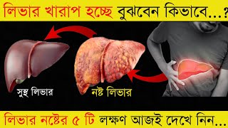 লিভার নষ্টের ৫টি Warning Signs | 5 early signs of liver damage | Stay Alert | দৈনিক স্বাস্থ্য