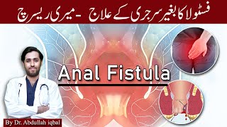 Fistula | What is Peri-anal Fistula? | Fistula Causes| Find out Best treatment without surgery