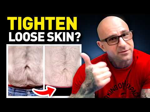 How do you shrink loose skin after weight loss? How do you shrink loose skin after weight loss?