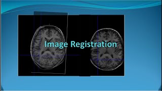 Image Registration [E5]